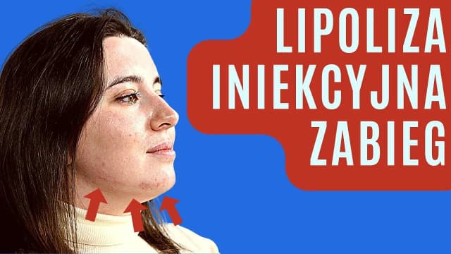 Czy po lipolizie można pić alkohol - poznaj najważniejsze zalecenia lekarzy Czy po lipolizie można pić alkohol - poznaj najważniejsze zalecenia lekarzy