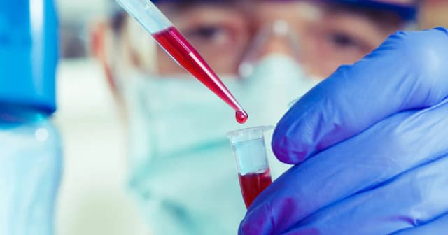 Jak długo jest ważne skierowanie do laboratorium? Uniknij problemów z ważnością Jak długo jest ważne skierowanie do laboratorium? Uniknij problemów z ważnością