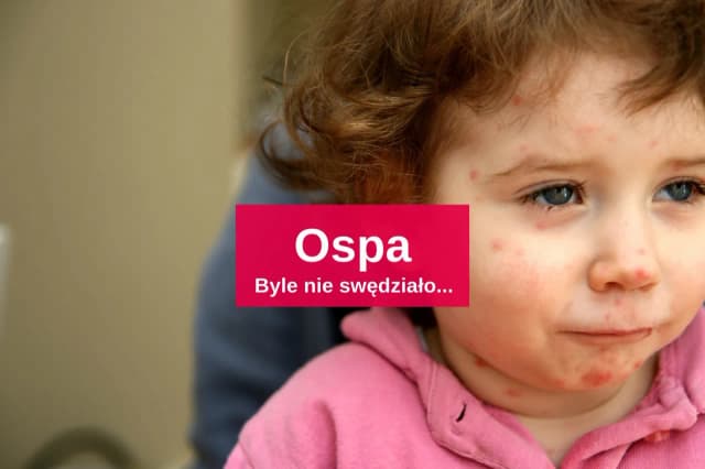 Jakie leki na ospę u dzieci? Skuteczne metody łagodzenia objawów Jakie leki na ospę u dzieci? Skuteczne metody łagodzenia objawów