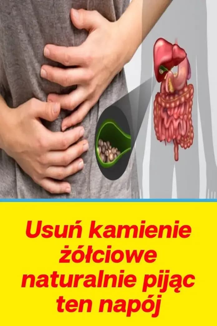 Skuteczne leki na kamienie żółciowe: Jak uniknąć bolesnej operacji Skuteczne leki na kamienie żółciowe: Jak uniknąć bolesnej operacji