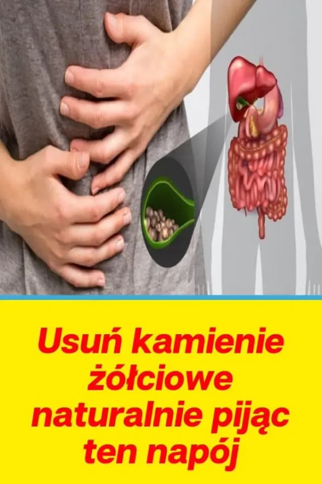 Skuteczne leki na kamienie żółciowe: Jak uniknąć bolesnej operacji Skuteczne leki na kamienie żółciowe: Jak uniknąć bolesnej operacji