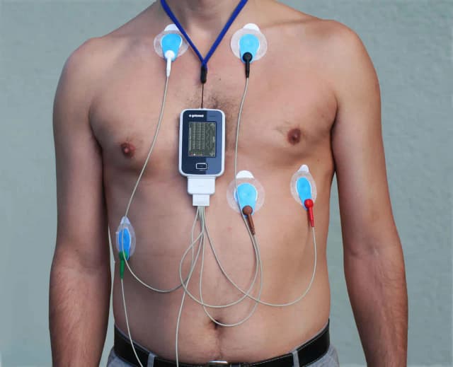 Czy Holter wykryje nerwicę? Ograniczenia badania EKG w diagnozie Czy Holter wykryje nerwicę? Ograniczenia badania EKG w diagnozie