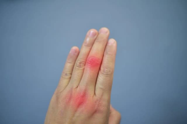 Kwas moczowy jakie badanie: jak przygotować się i co oznacza wynik Kwas moczowy jakie badanie: jak przygotować się i co oznacza wynik