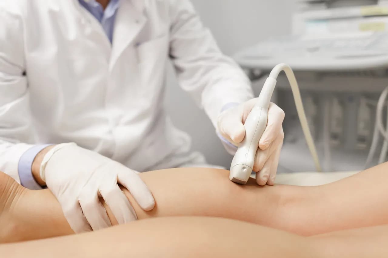 Znaczenie regularnych badań naczyń krwionośnych nóg Znaczenie regularnych badań naczyń krwionośnych nóg