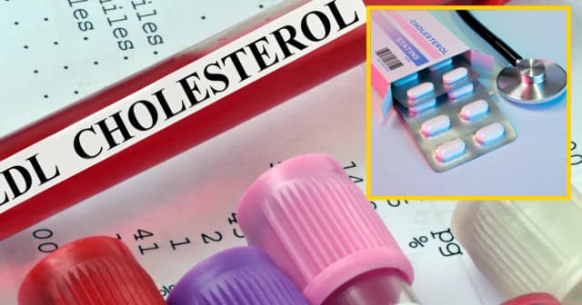 Czy leki na cholesterol odchudzają? Sprawdź, co mówią badania Czy leki na cholesterol odchudzają? Sprawdź, co mówią badania