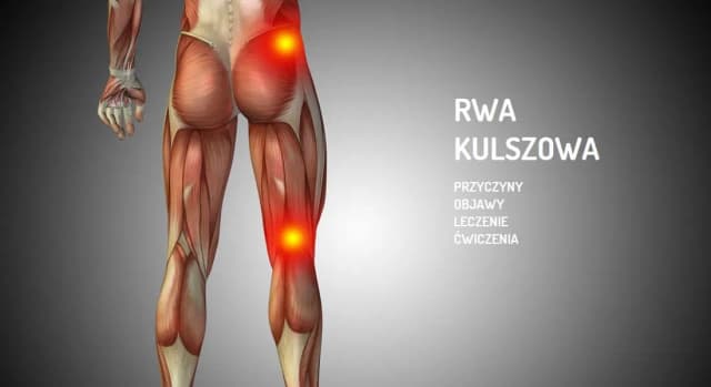 Rwa kulszowa a ból kolana: objawy, które musisz znać Rwa kulszowa a ból kolana: objawy, które musisz znać