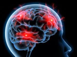 Objawy zaburzeń układu nerwowego – jak rozpoznać problemy neurologiczne? Objawy zaburzeń układu nerwowego – jak rozpoznać problemy neurologiczne?