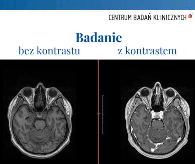 Alkohol po kontraście: czy można pić i jakie są zagrożenia? Alkohol po kontraście: czy można pić i jakie są zagrożenia?