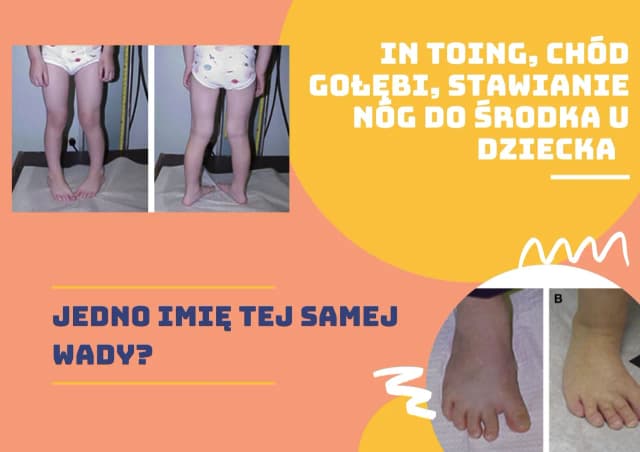 Gołębi chód u dzieci: przyczyny, objawy i skuteczne leczenie Gołębi chód u dzieci: przyczyny, objawy i skuteczne leczenie